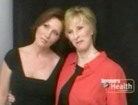 Facelift Los Angeles California